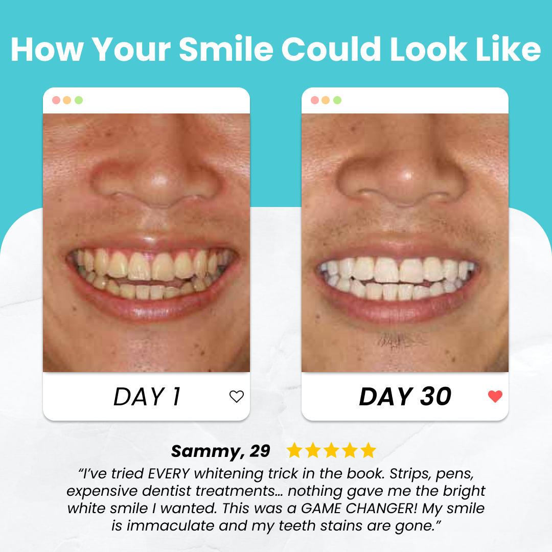 👑LAST DAY UP TO 70% off!Buy More Save More👑Scandinaviansmiles™ smiles new upgraded automatic self-brushing toothbrush
